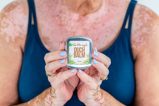 Summer is Around the Corner and So is Your Next Eczema Flare!